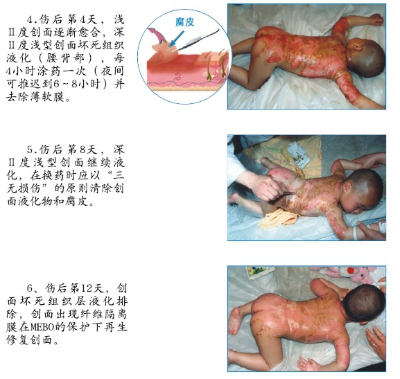 k8凯发官网(中国)天生赢家·一触即发
