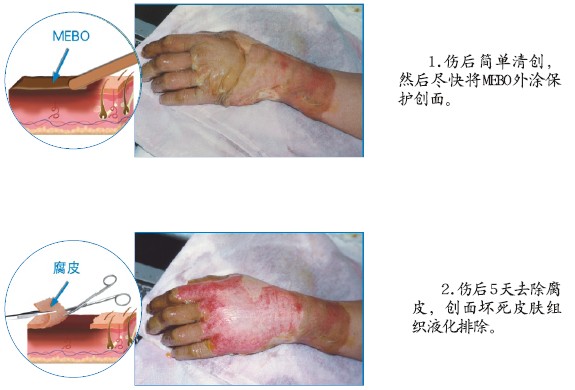 k8凯发官网(中国)天生赢家·一触即发