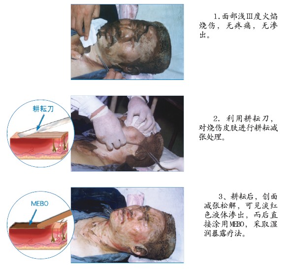k8凯发官网(中国)天生赢家·一触即发