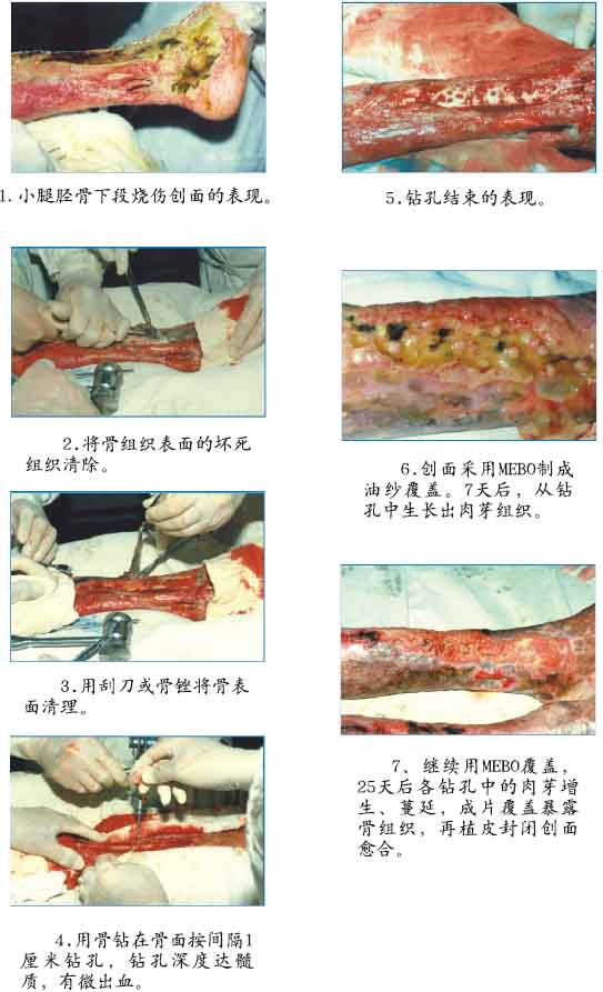 k8凯发官网(中国)天生赢家·一触即发