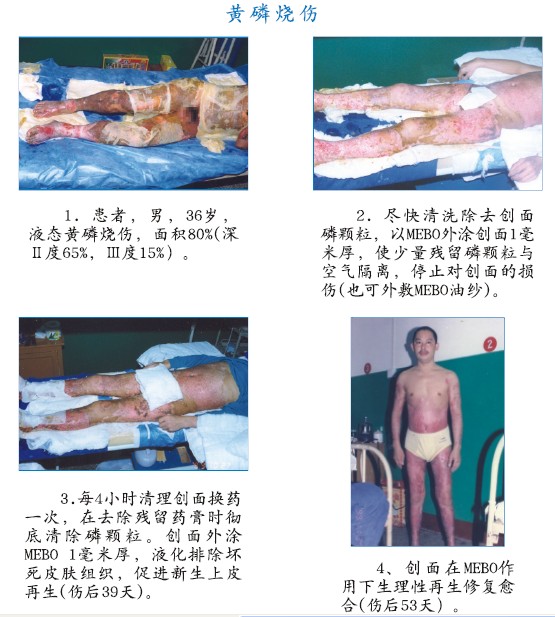 k8凯发官网(中国)天生赢家·一触即发