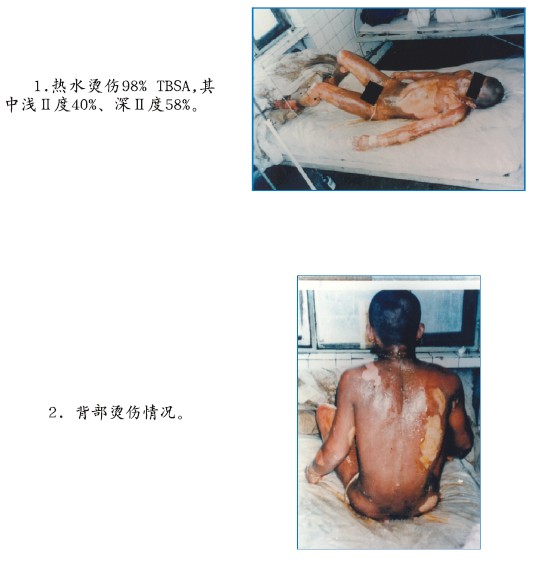 k8凯发官网(中国)天生赢家·一触即发