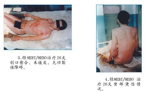 k8凯发官网(中国)天生赢家·一触即发