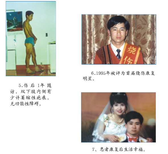 k8凯发官网(中国)天生赢家·一触即发