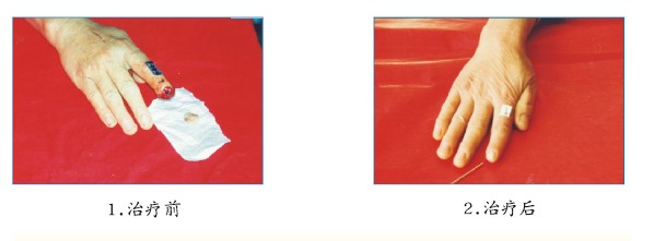 k8凯发官网(中国)天生赢家·一触即发