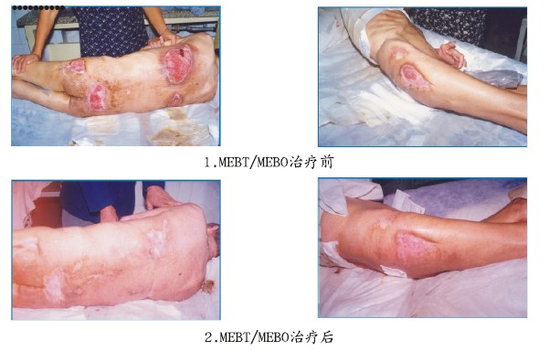 k8凯发官网(中国)天生赢家·一触即发