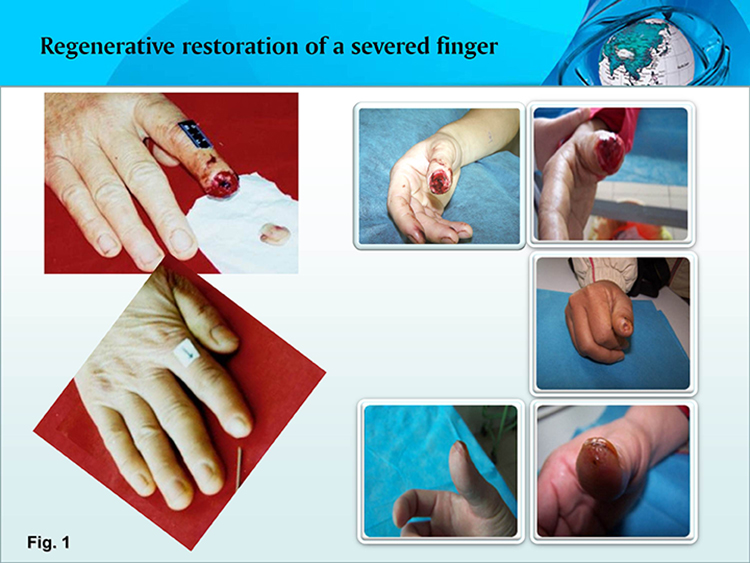 k8凯发官网(中国)天生赢家·一触即发