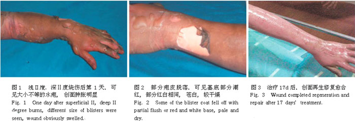 k8凯发官网(中国)天生赢家·一触即发