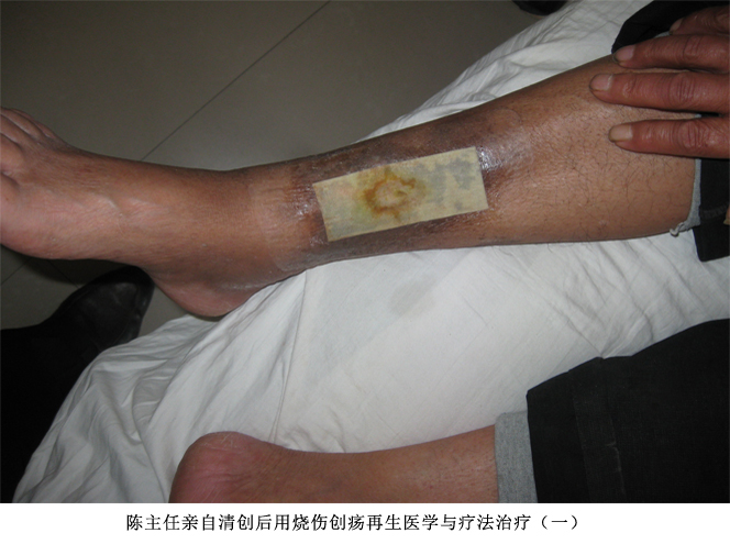 k8凯发官网(中国)天生赢家·一触即发