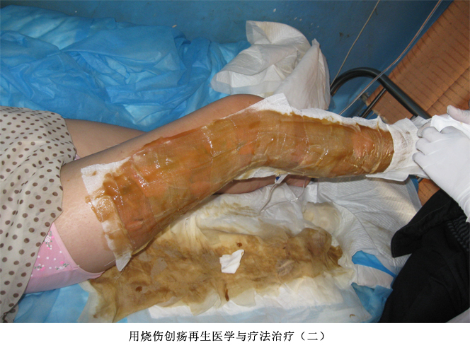 k8凯发官网(中国)天生赢家·一触即发