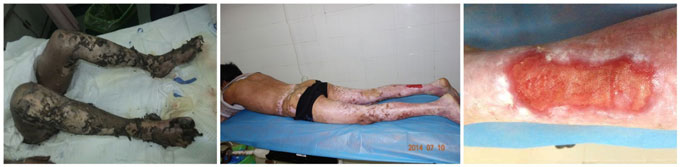 k8凯发官网(中国)天生赢家·一触即发