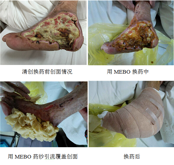 k8凯发官网(中国)天生赢家·一触即发