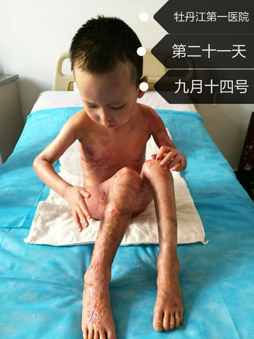 k8凯发官网(中国)天生赢家·一触即发